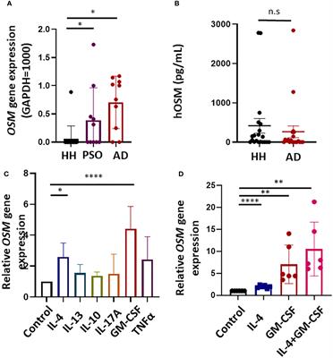 Oncostatin M suppresses IL31RA expression in dorsal root ganglia and interleukin-31-induced itching